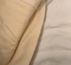 Shirt discoloration